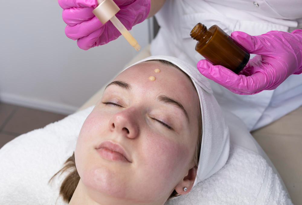 Melasma Treatment